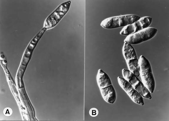 Antipodium arechae. A. conidiophores and conidiogenesis; B. conidia X1380. 