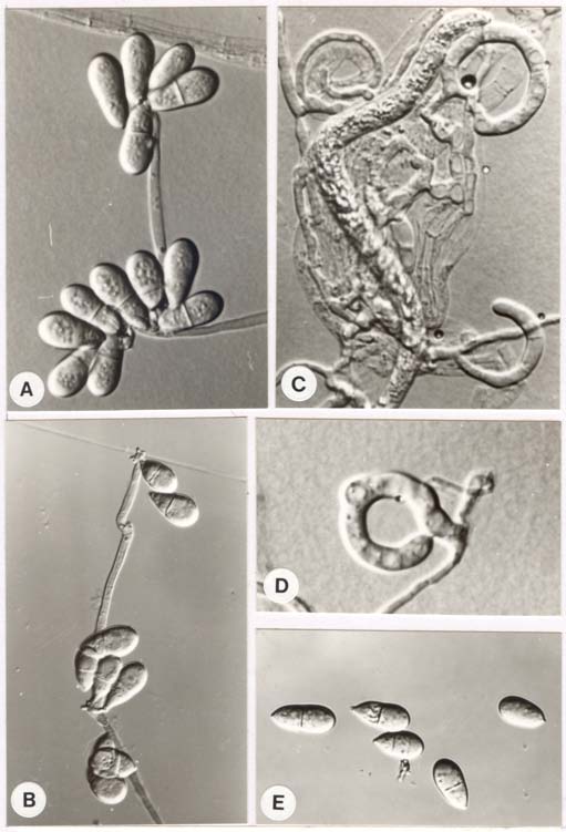 Arthrobotrys conoides BCRC 32660. A-B: conidiophores and conidia; C: captured nematode; D: adhesive net; E: conidia. 