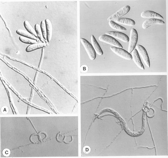 Arthrobotrys musiformis BCRC 32758. A: conidiophore and conidia; B: conidia; C: adhesive nets; D: captured nematodes. 