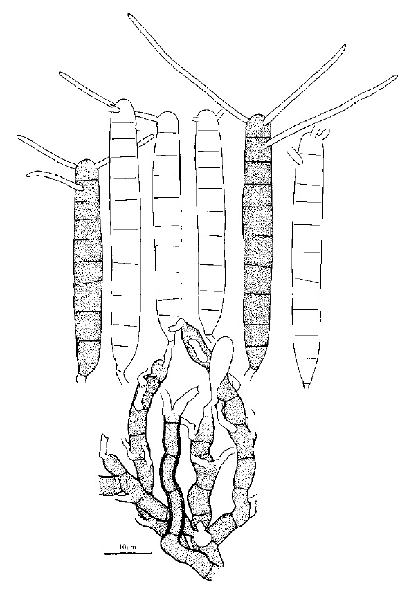 Camposporium antennatum. Conidiophores and conidia. 