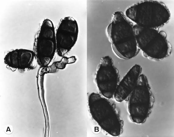 Curvularia tuberculata. A. Conidiophores and conidia; B. conidia X 1390. 