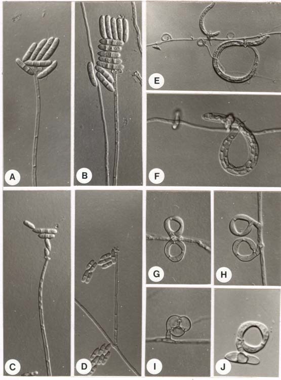 Dactylaria brochopaga BCRC 32659. A-D: conidiophore and conidia; E-J: constricting rings and captured nematodes. 