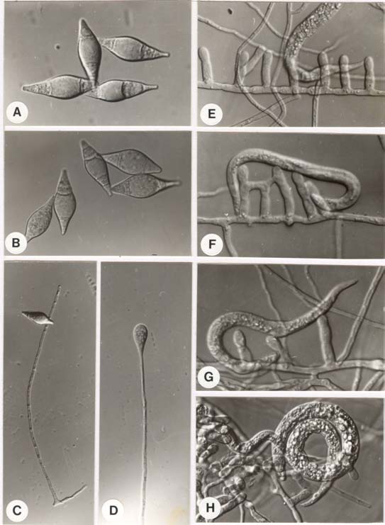Monacrosporium cionopaga BCRC 32658. A-B. conidia; C-D. conidiophores; E-H. mesh-like trapping devices and captured nematodes. 