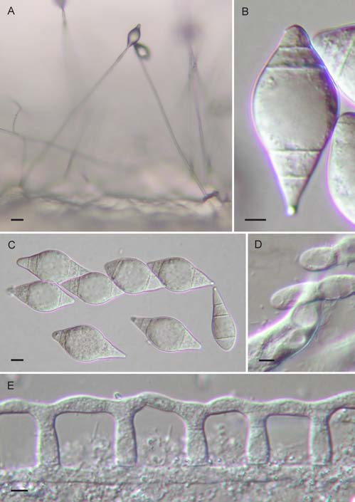 Monacrosporium gephyropagum. A. Conidiophores with conidia. B-C. Conidia. D. Adhesive branches with captured nematode within which an infective bulb is visible. E. Adhesive branches, showing the lateral fusion of individual branched to form a scalariform network. Bars: A = 20 μm; B-E = 5 μm. 
