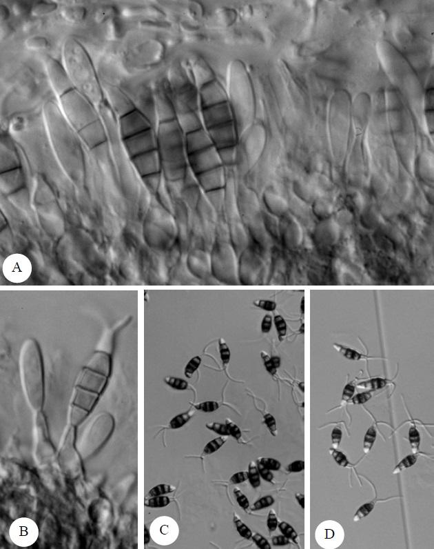 Pestalotiopsis adusta. A-B. Sporodochia stromatic, conidiogenous cellphialidic, broadly ampulliform, 1310X; C-D. Conidia cylindrical, pigmented,4- septate, with apical appendages, 330X. 
