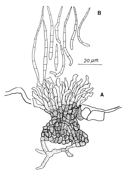 Pseudocercospora diversispora: A, Fascicle of conidiophores. B, Conidia. 