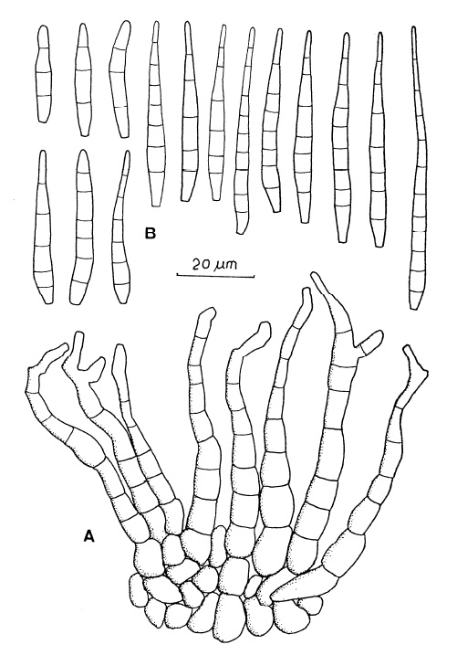 Pseudocercospora hyaloconidiophora: A, Fascicle of conidiophores. B, Conidia. 