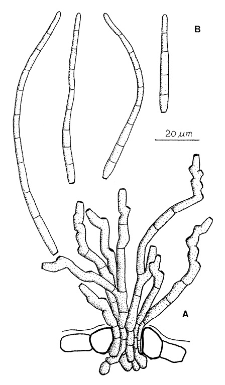 Pseudocercospora juglandis: A, Fascicle of conidiophores. B, Conidia. 